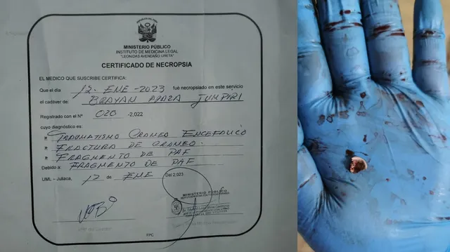 Certificado de Necropsia - Brayan Apaza Jumpiri