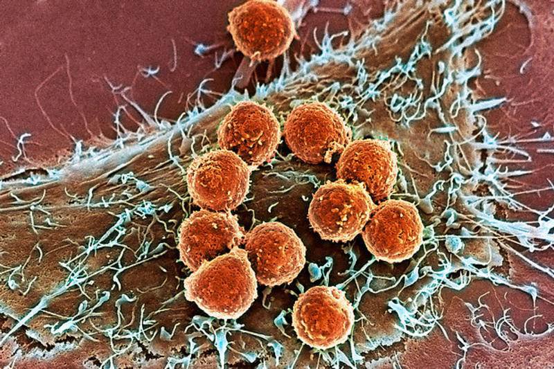 Defensas-editadas-con-CRISPR-muestran-su-seguridad-en-pacientes-con-cancer.jpg