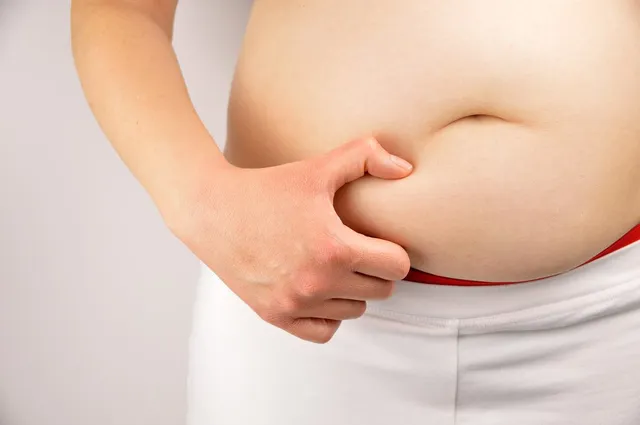 Descubre-cuáles-son-los-10-tipos-de-obesidad.jpg