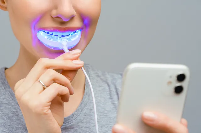 Dientes