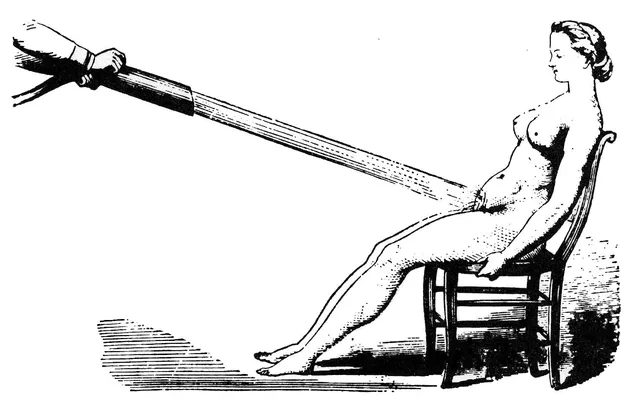 Duchas-vaginales-como-tratamiento-para-la-histeria.-Wikimedia-Commons