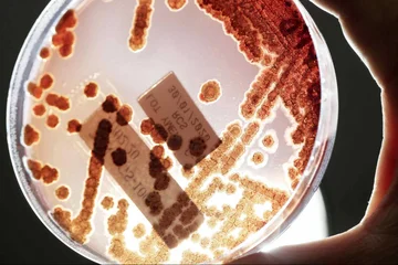 Las-infecciones-por-bacterias-multirresistentes-causan-mas-muertes-que-el-sida-o-la-malaria