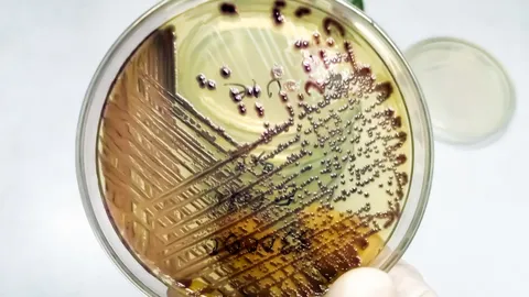 bacteria-colony-of-escherichia-coli-or-ecoli-in-culture-media-plate (1)