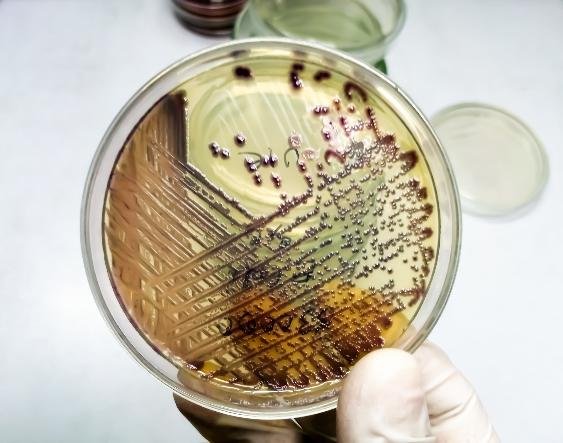 bacteria-colony-of-escherichia-coli-or-ecoli-in-culture-media-plate (1)