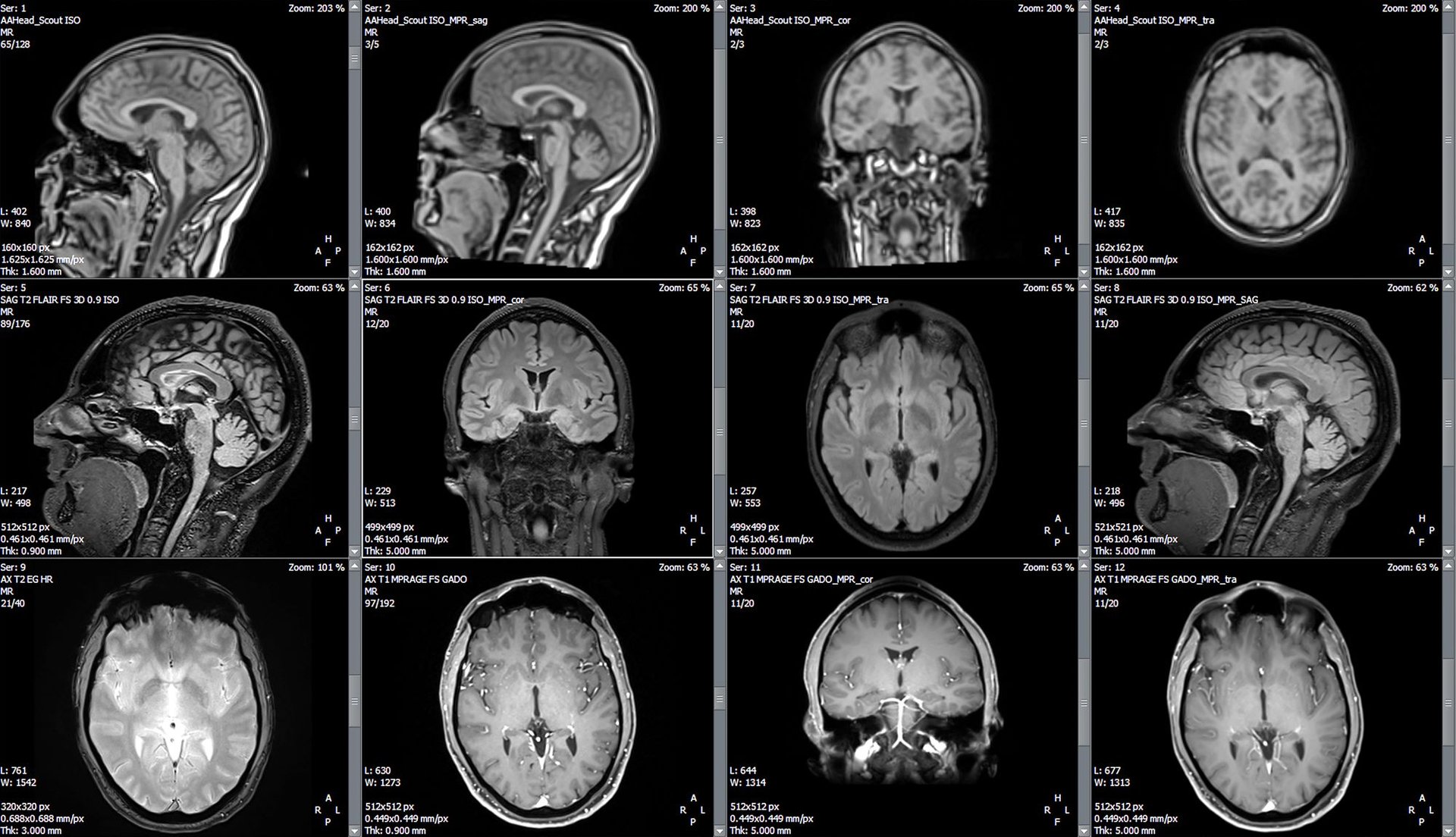 Radiografias de cerebro