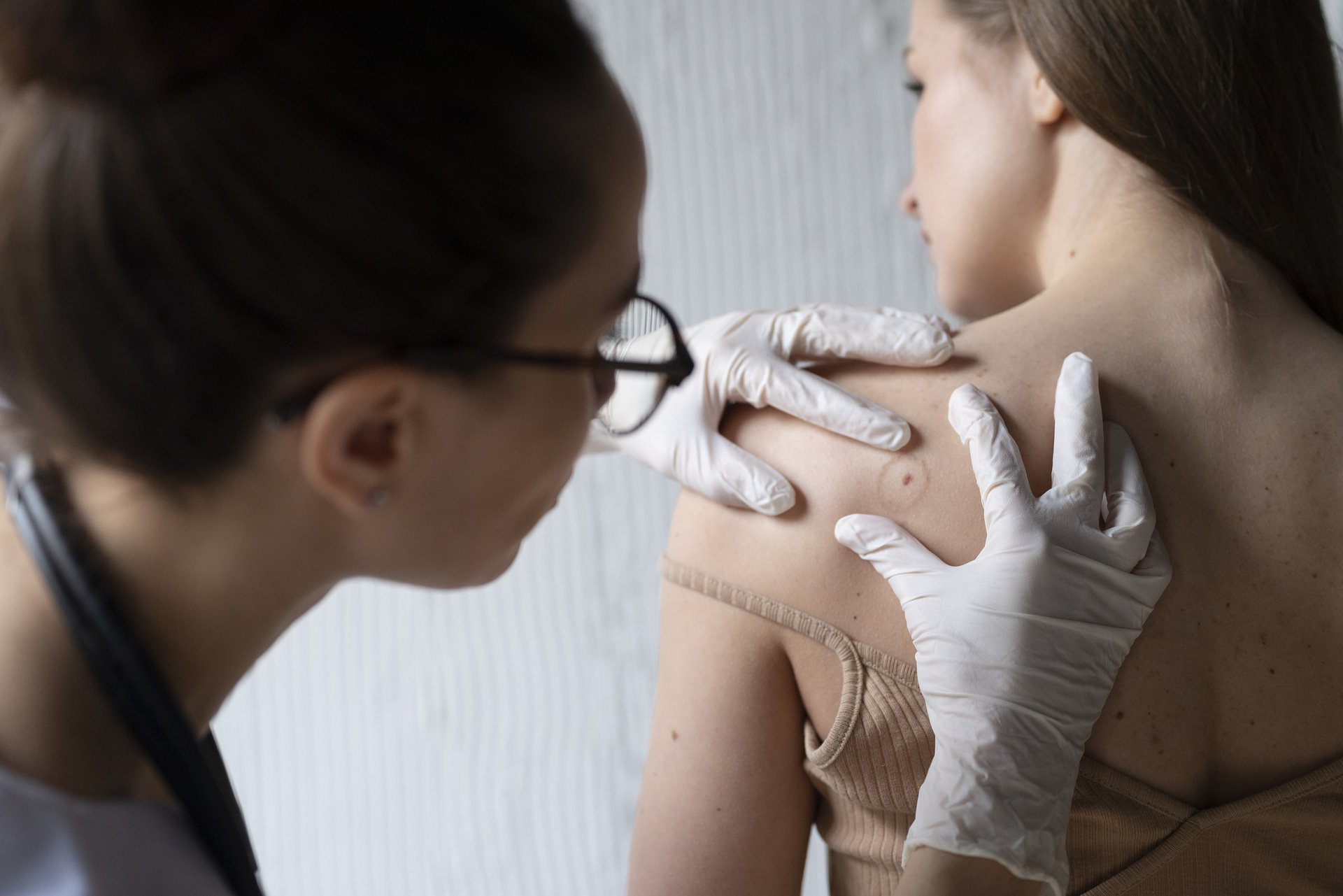 female-doctor-diagnosing-melanoma-on-the-body-of-female-patient