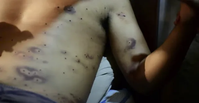 herido perdigones peaje Puente Piedra.PNG