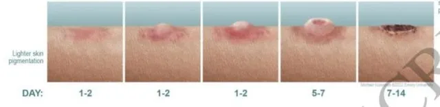 skin presentation