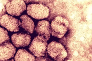 virus-de-la-viruela