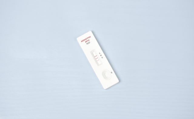 virus-de-la-viruelamono